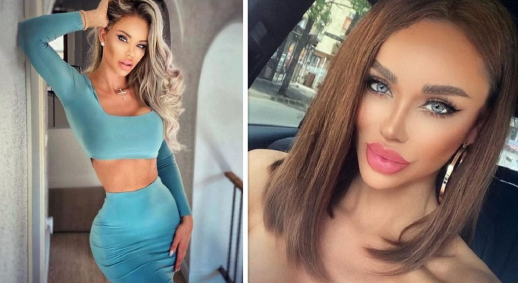 Bianca Drăgușanu, din nou pe mâna chirurgului plastician. Ce plănuiește să își facă acum vedeta