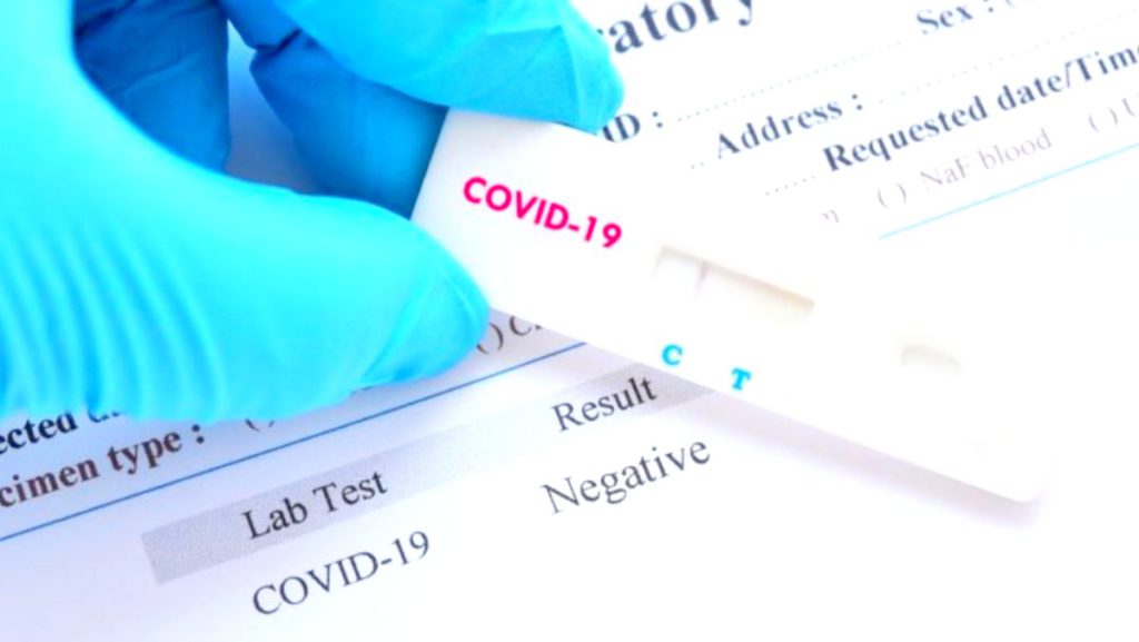 Românii au dat buzna să-și facă testul pentru noul virus. Cât se așteaptă acum după rezultate la clinicile private