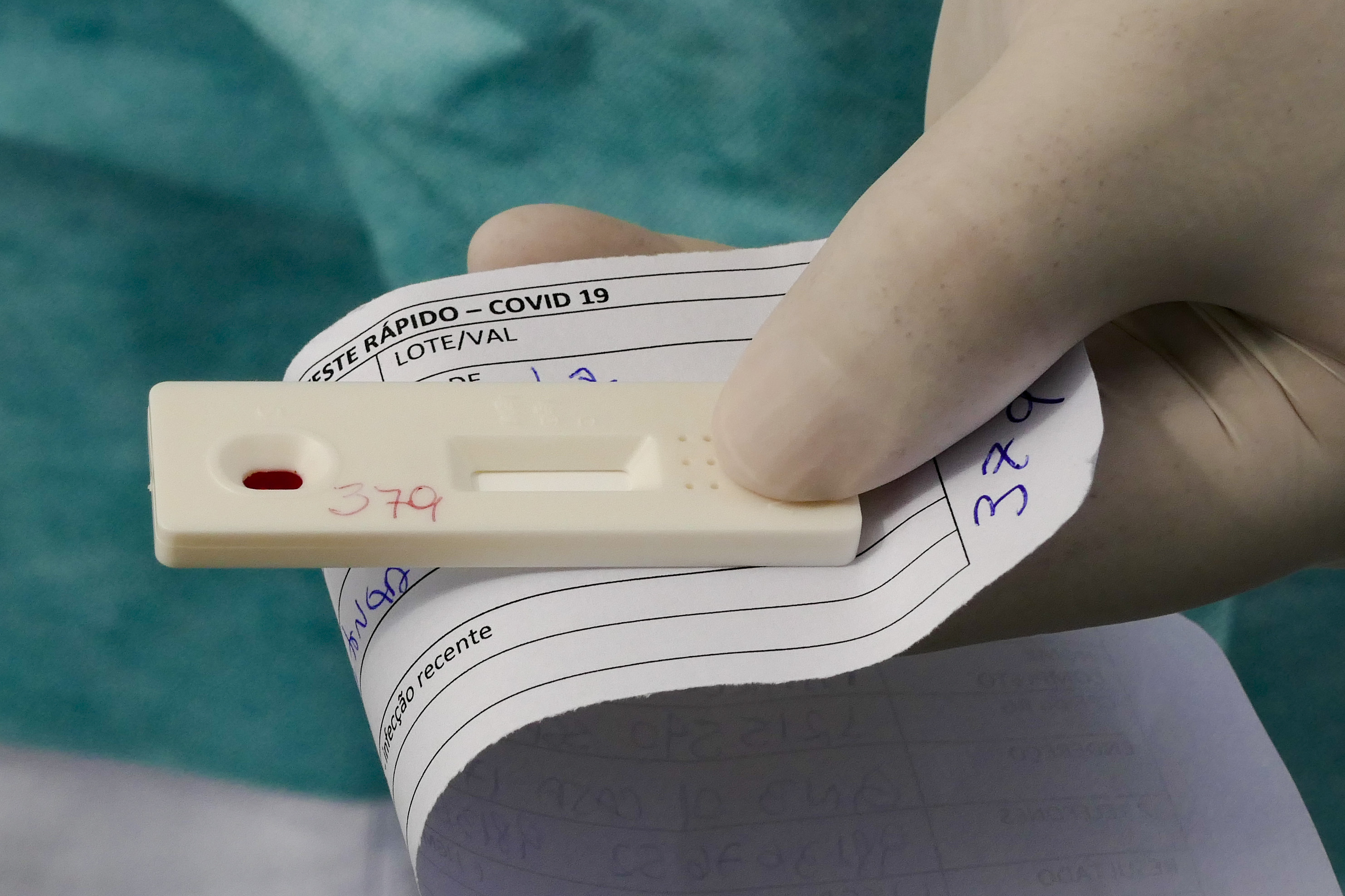 Tratamentul a fost folosit initial pentru tuberculoza