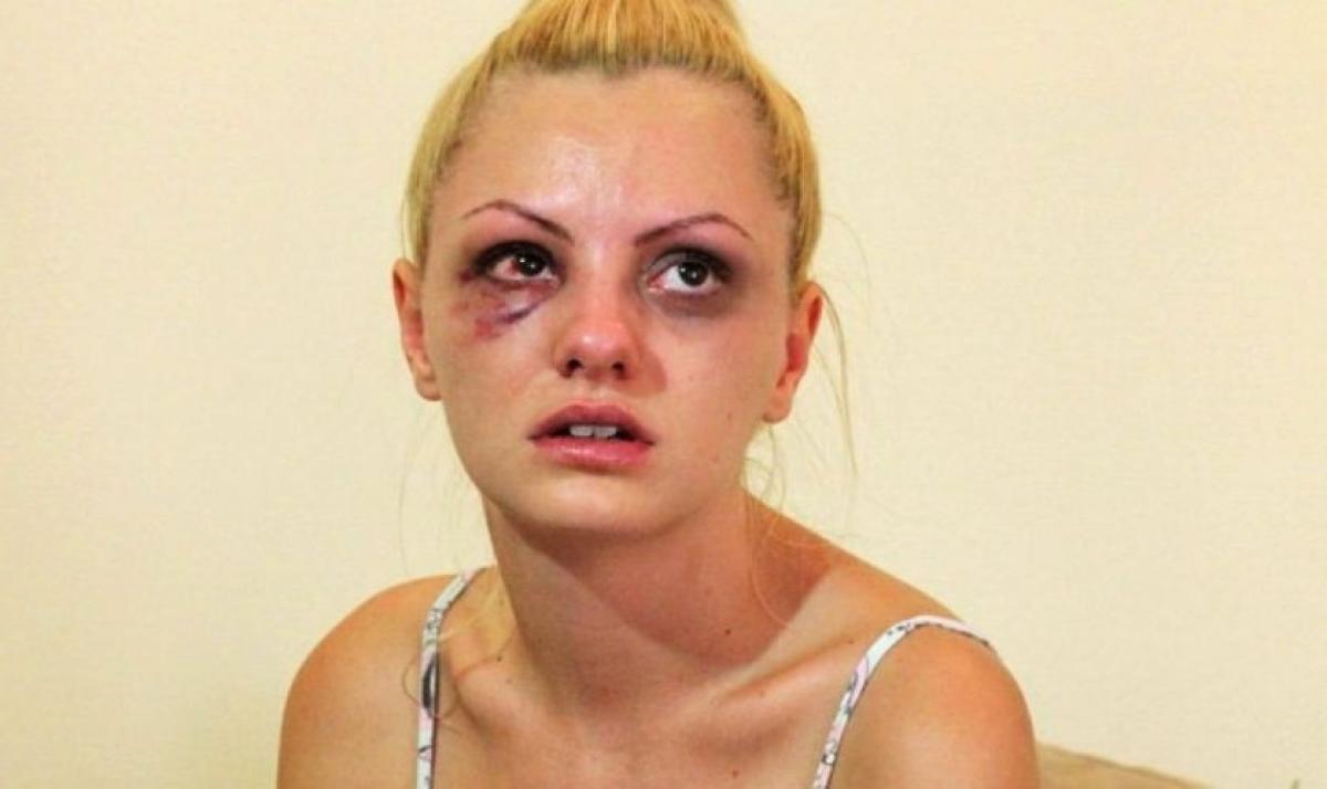 Alexandra Stan a fost batuta cu bestialitate de fostul ei iubit, in 2013