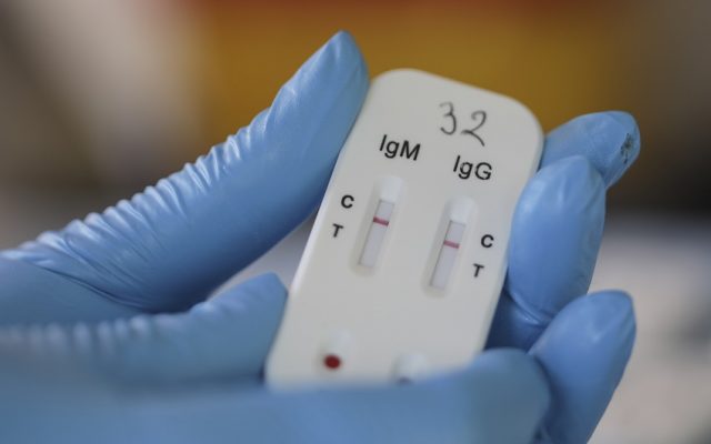Tara care ofera gratuit teste de coronavirus