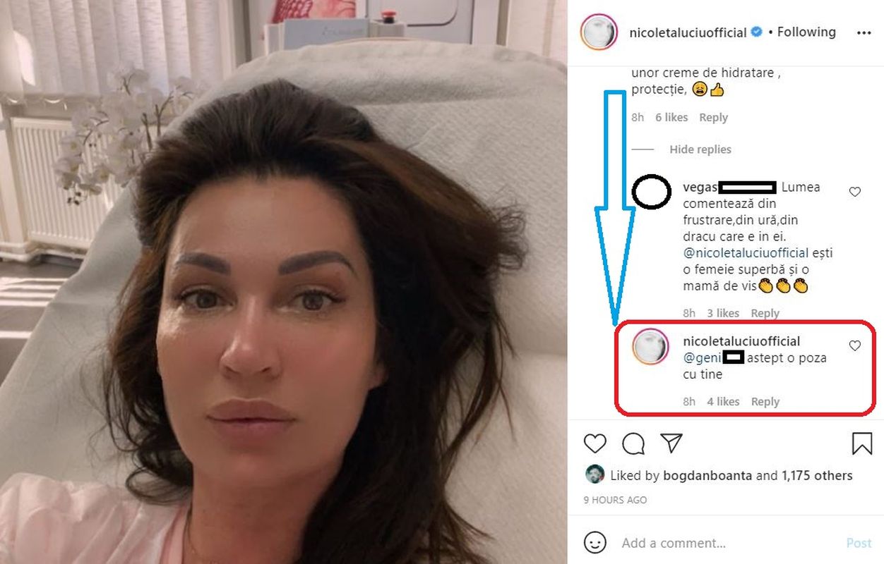 Nicoleta Luciu a postat o poza dupa un tratament, dar reactiile nu au fost asa cum isi imagina