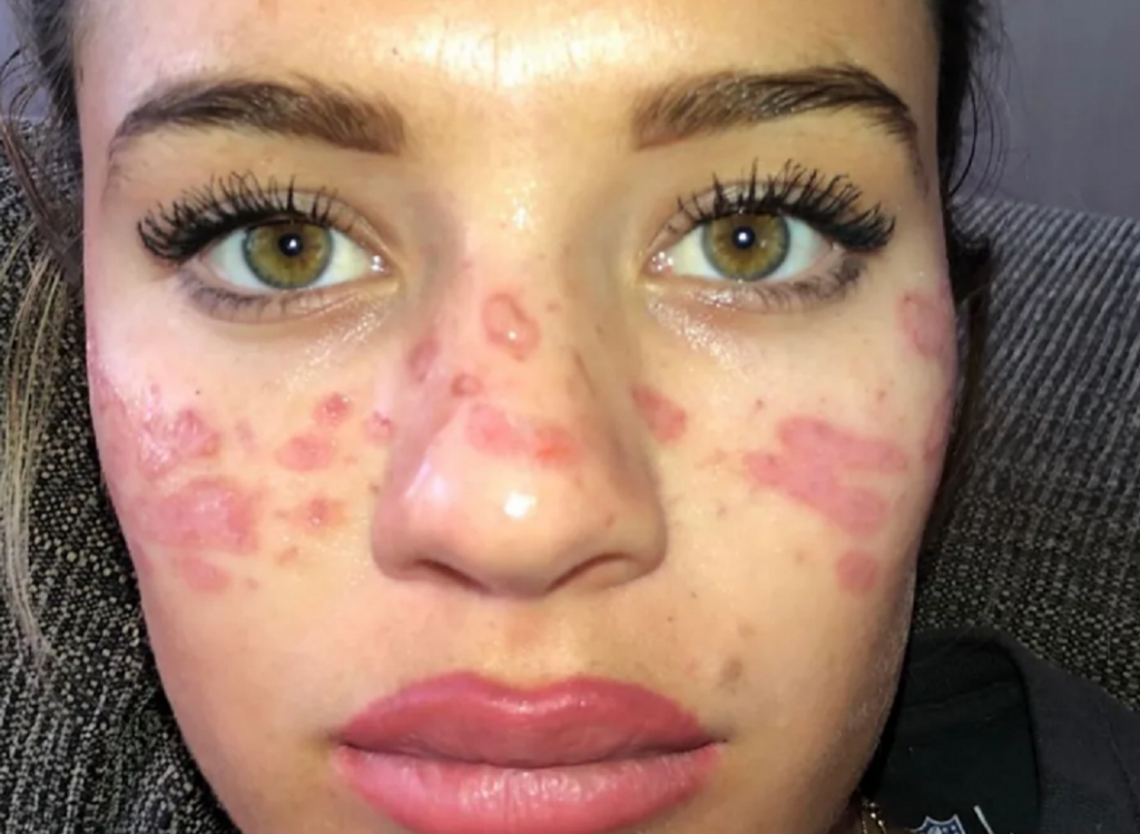 Tanara a facut un truc de infrumusetare vazut pe TikTok