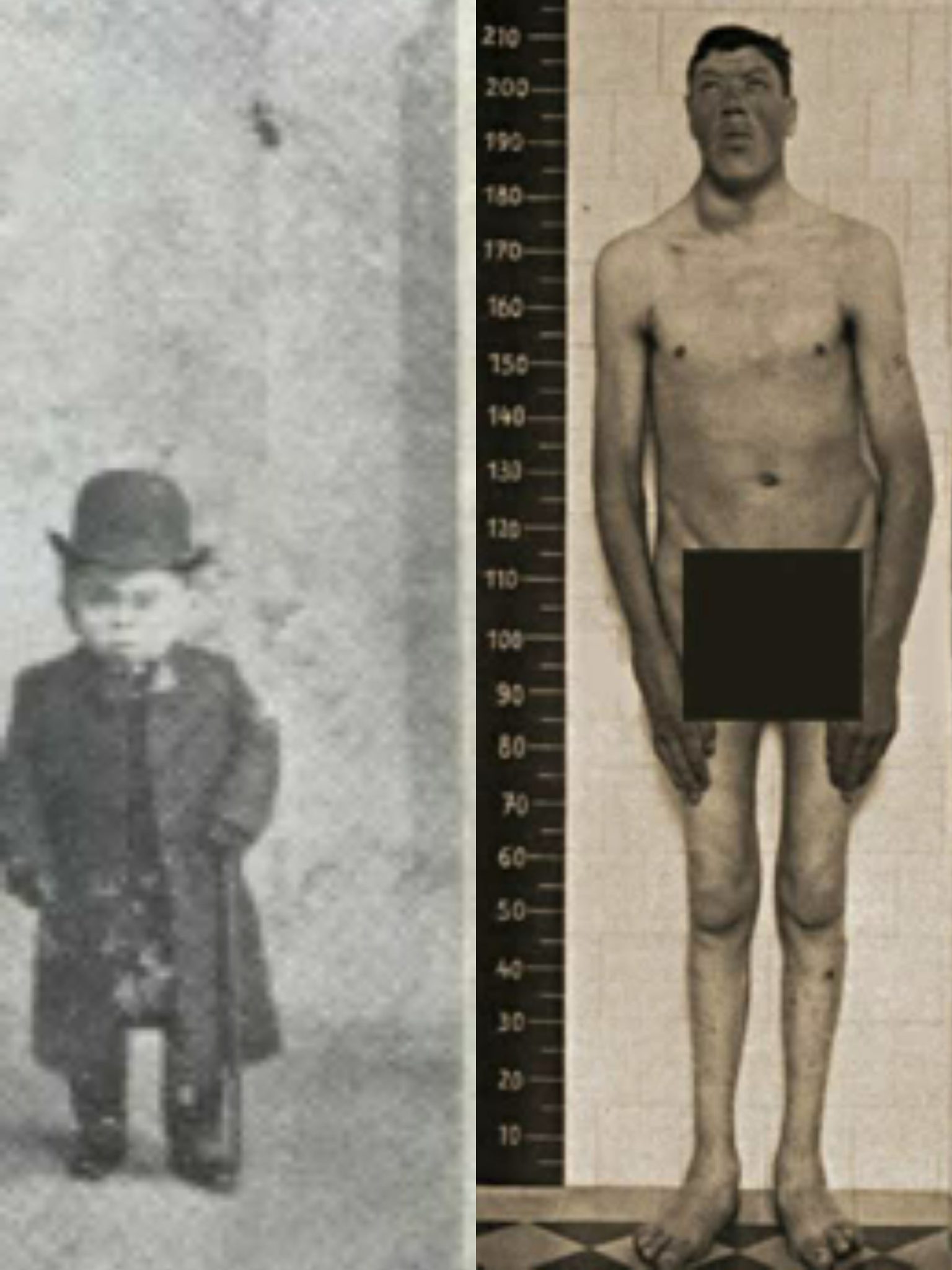 Povestea lui Adam Rainer, piticul gigant