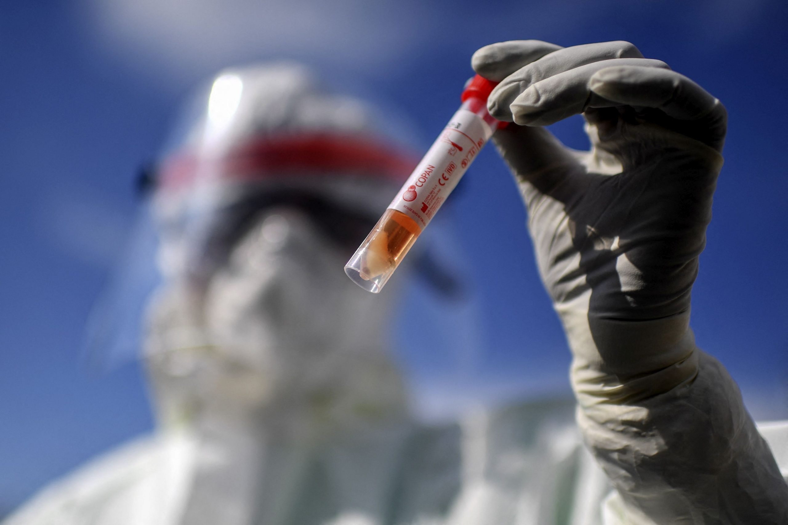 A fost depășită bariera de 200 de milioane de cazuri de covid în lume