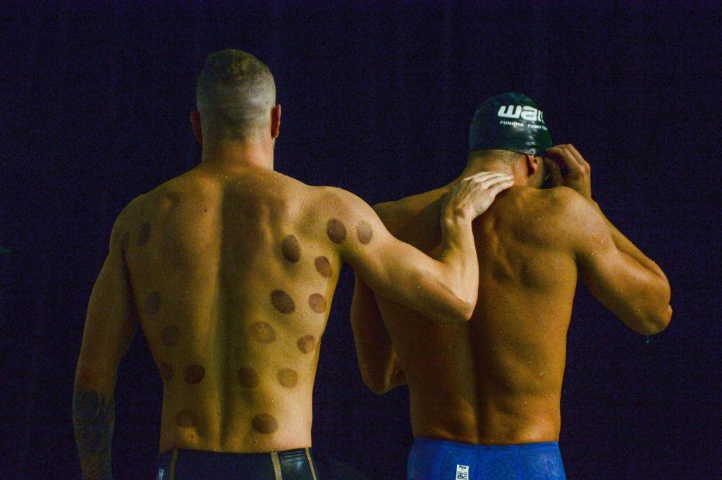 Motivul pentru care unii sportivi de la Olimpiadă au pete rotunde pe corp. Imaginile controversate fac înconjurul lumii