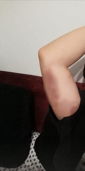 Un politist din Iasi si-a batut fosta sotie pana a invinetit-o