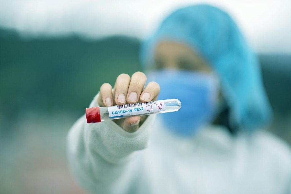 Studiul a 50.000 de teste covid-19 a demonstrat. PCR-ul negativ nu exclude infectia cu virusul
