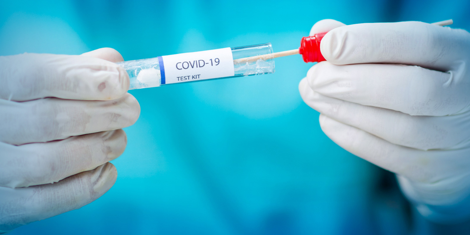 Franța ajunge din nou la 10.000 de cazuri de covid pe zi. Și numărul spitalizărilor a crescut