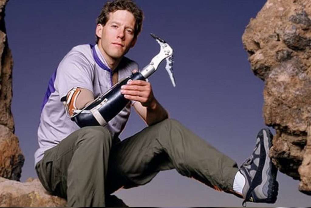 Oameni extraordinari care si-au depasit limitele fizice