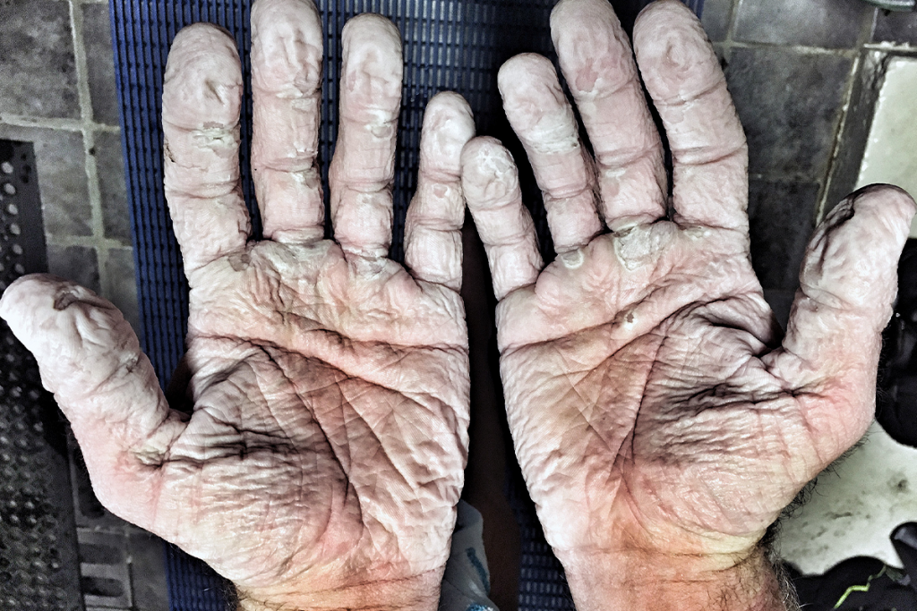 Oameni extraordinari care si-au depasit limitele fizice 