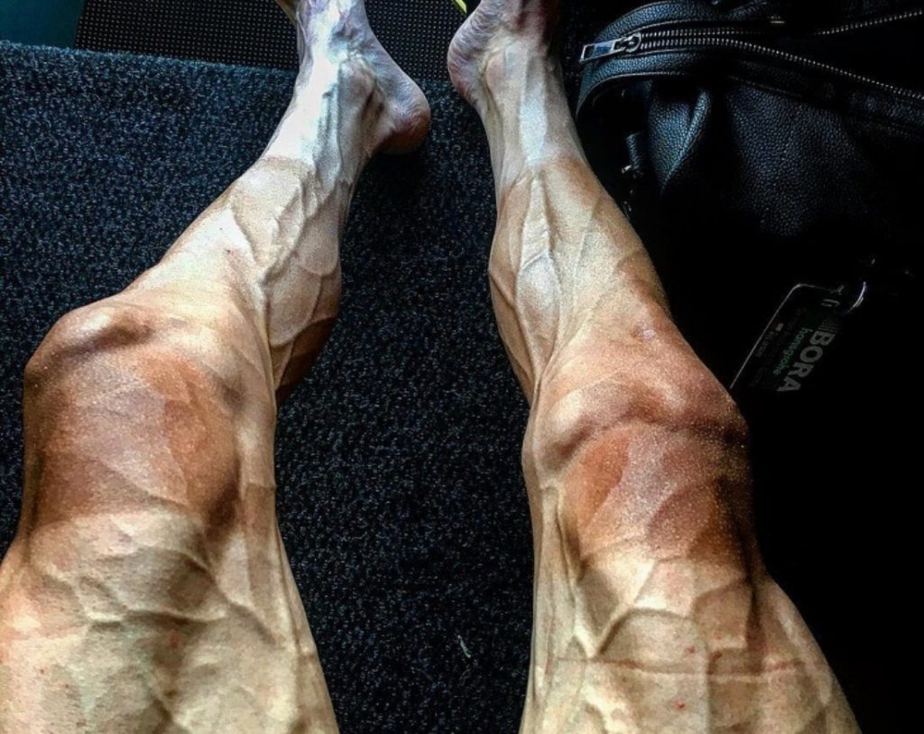 Oameni extraordinari care si-au depasit limitele fizice