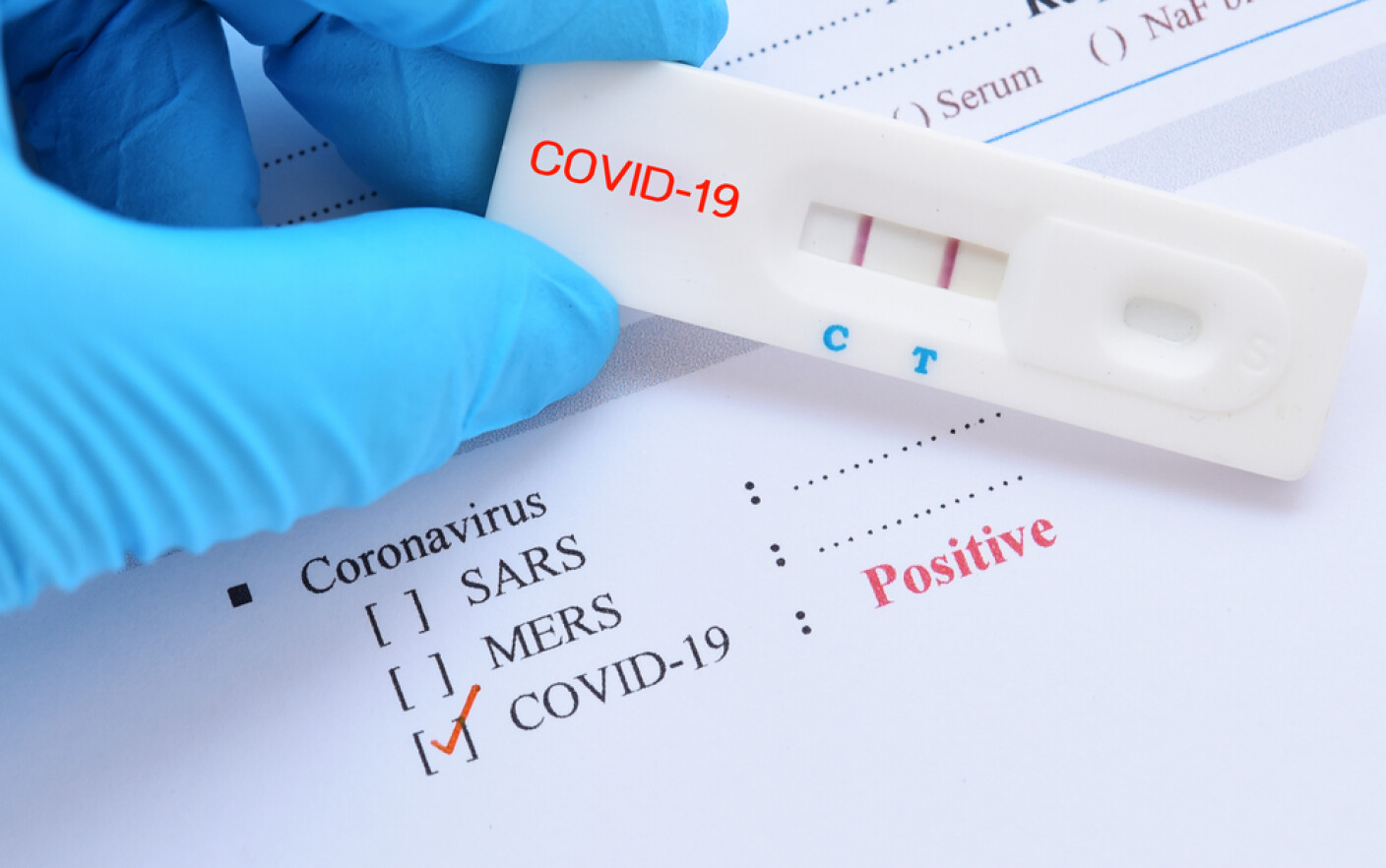 Documentul pentru concediu medical covid-19
