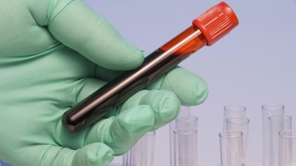 România presată să renunțe la taxa clawback de 6 companii farmaceutice. S-a vizat limitarea aprovizionării cu imunoglobuline