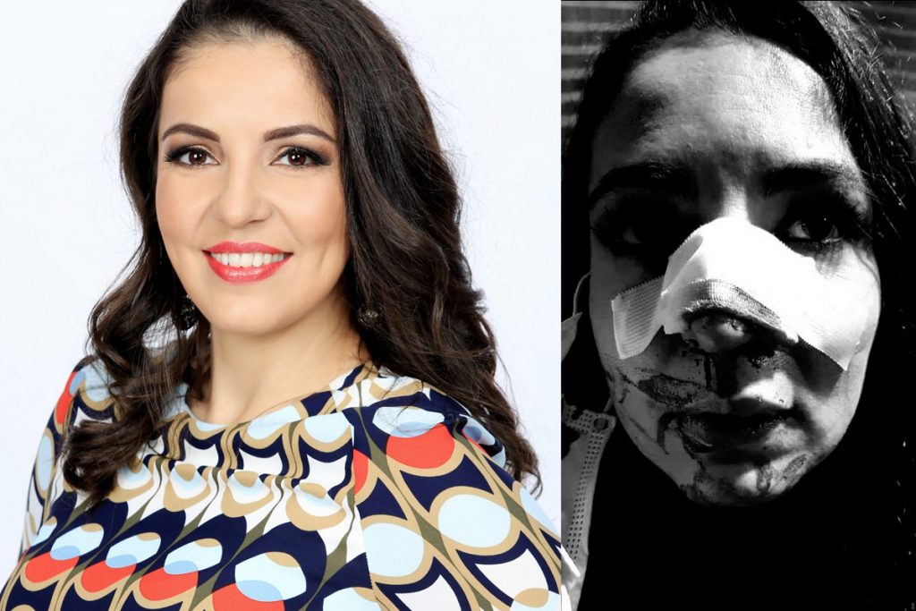 Arhitectul Visuri la Cheie a suferit mult in urma agresiunii