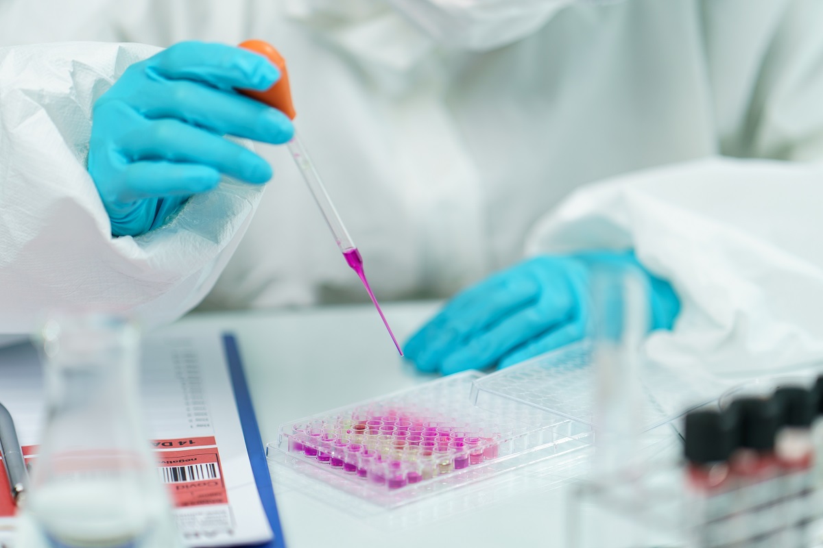 Prima persoană din lume depistată pozitiv la coronavirus, variola maimuței și HIV, în același timp