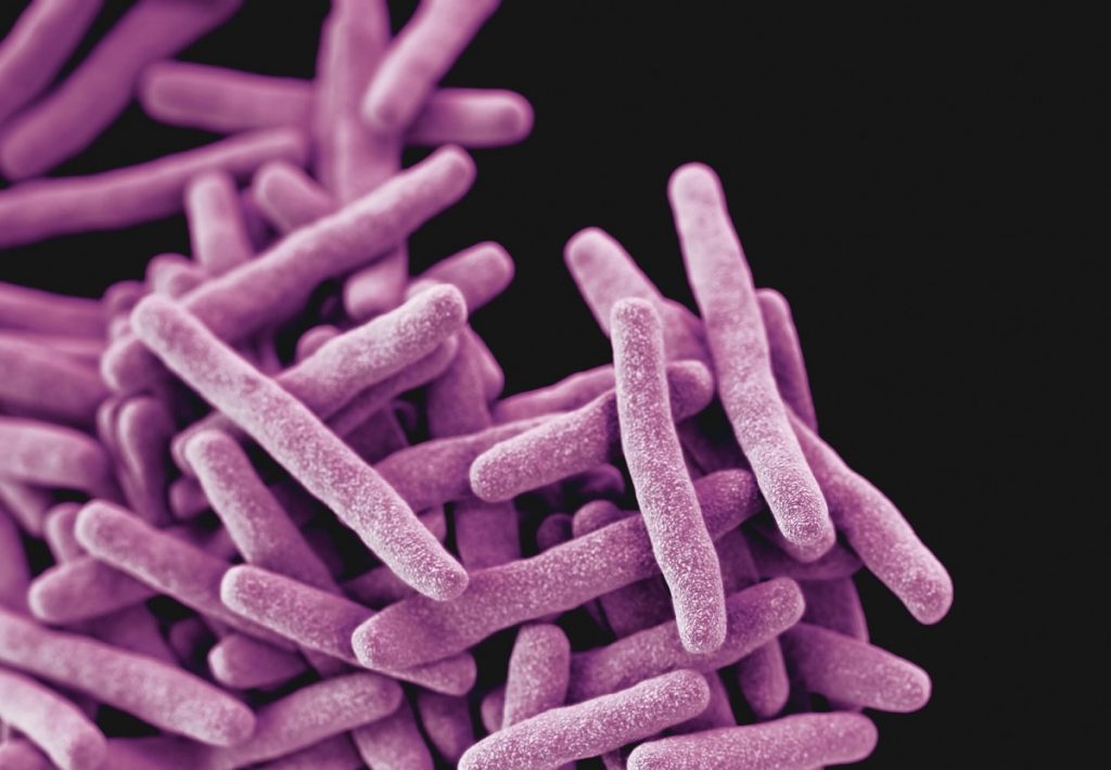 Medicii români lansează un avertisment cu privire la răspândirea tuberculozei. Există un regres major în controlul bolii