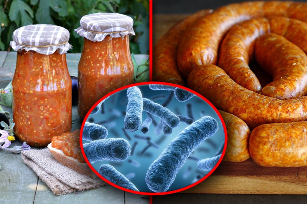 Bacteria periculoasă care poate fi prezentă în borcanele cu zacuscă. Nu le consuma dacă observi asta pe capac