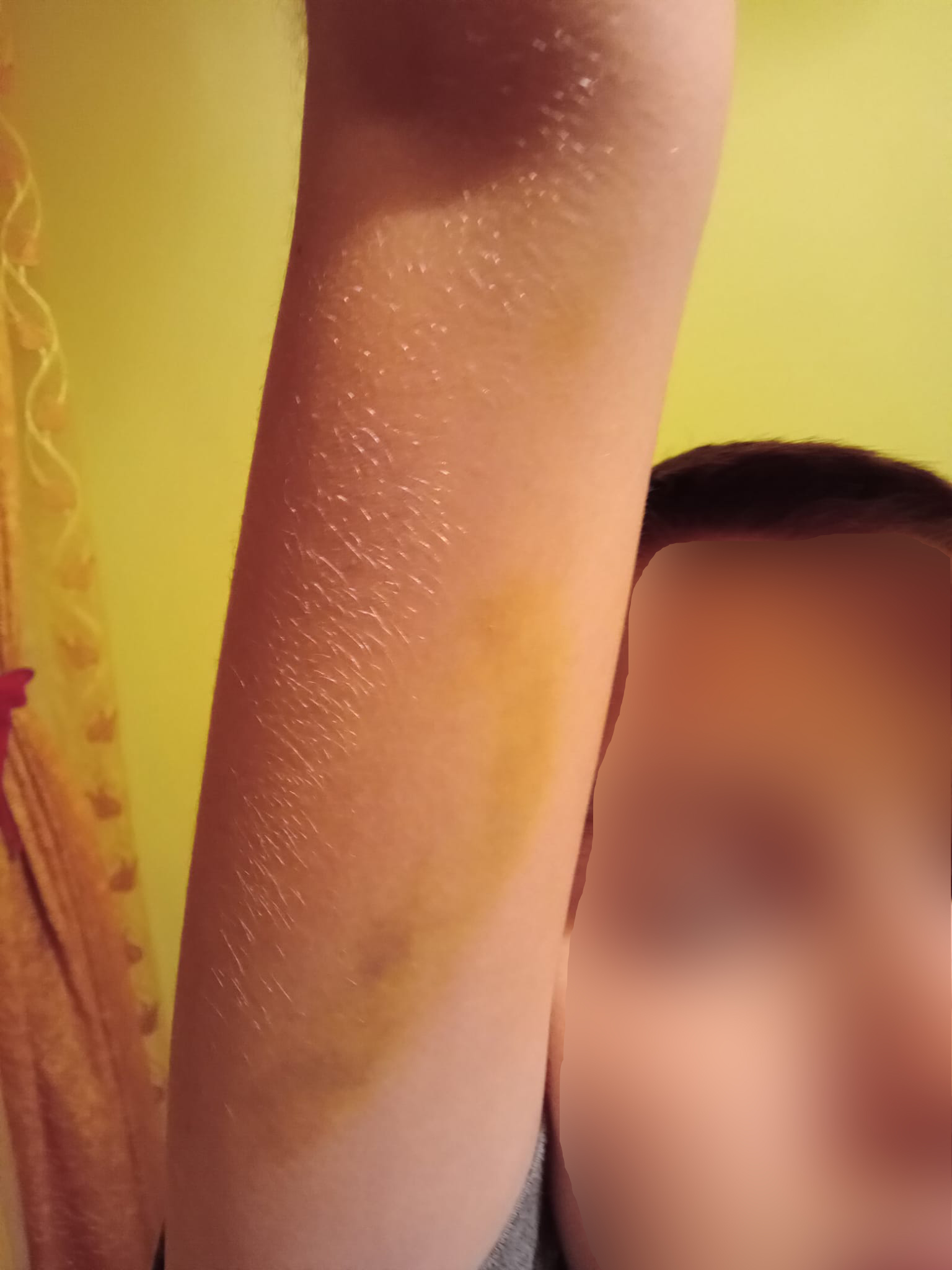 Elev traumatizat la o scoala din Prahova