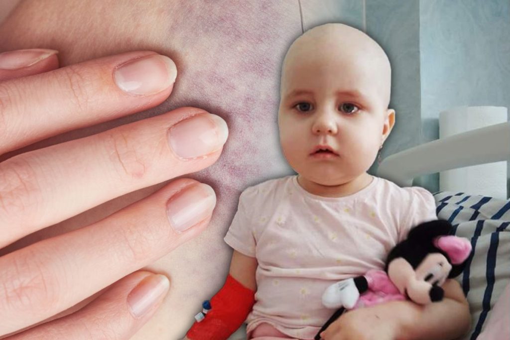 Ella, o fetiță cu leucemie din Cluj, are nevoie de ajutor. „Mă rog ca Dumnezeu să-i dea sănătate și să o vindece”