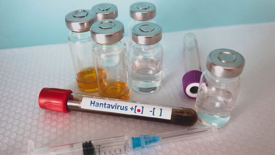 Argentina a refăcut traseul cetățenilor decedați, „pacienții zero” contaminați cu hantavirus